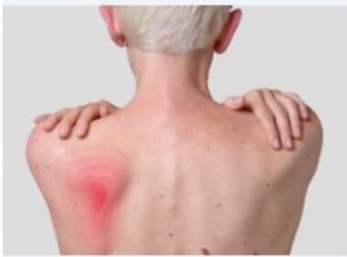 Skin and wound care education