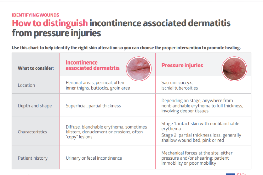 How to Distinguish Incontinence-Associated Dermatitis vs Pressure Injuries