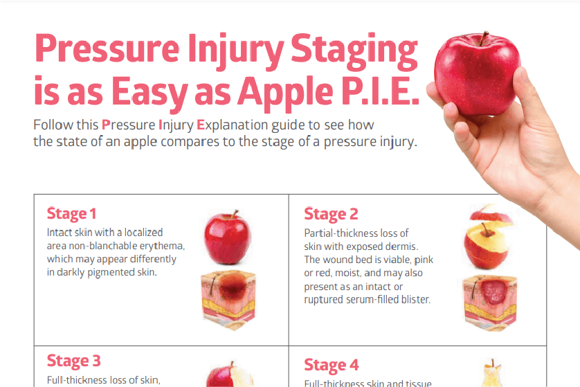 Pressure Injury Staging Made Simple (Apple P.I.E.)