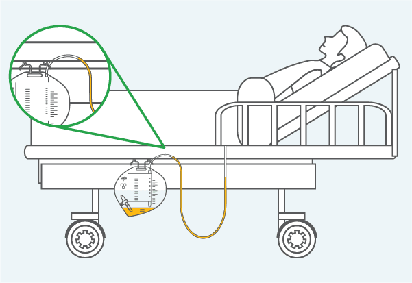 What is a Dependent Loop?