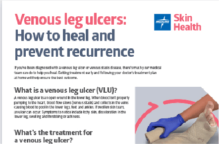 How to Heal and Prevent Reoccurence of Venous Leg Ulcers