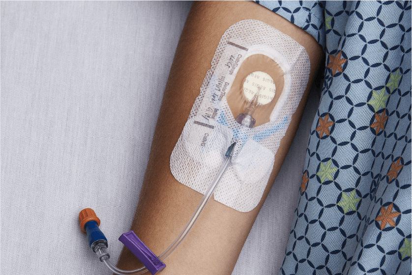 CLABSI Prevention Basics for Nurses (1.0 CE)