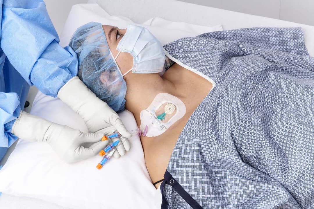 Vascular Access Device Selection Best Practices (1.0 CE for Nurses)