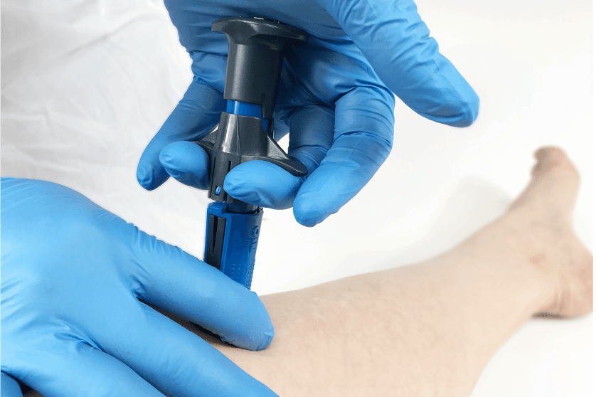 Intraosseous (IO) Access Training for Nurses