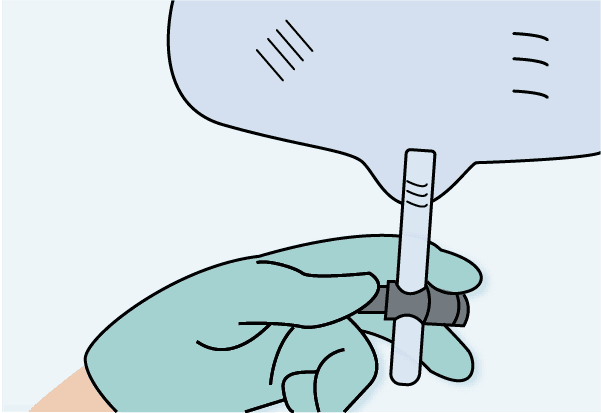 Best Practice for IUCs