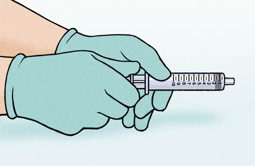 Deflating the Balloon of an IUC