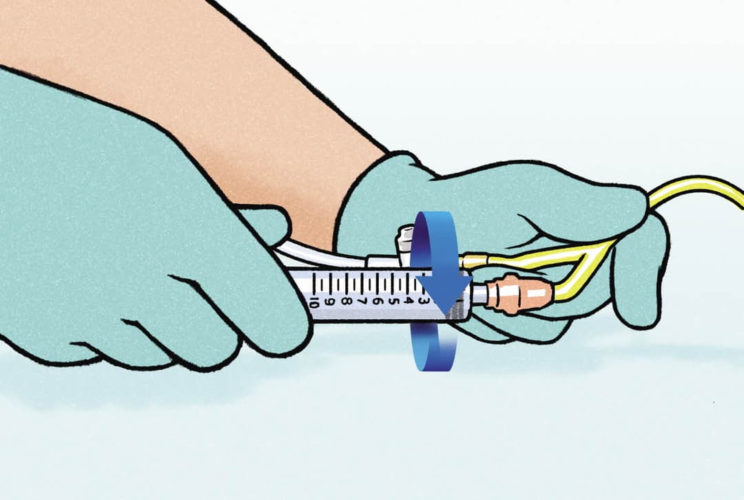 Does Your Patient Need an Indwelling Urinary Catheter