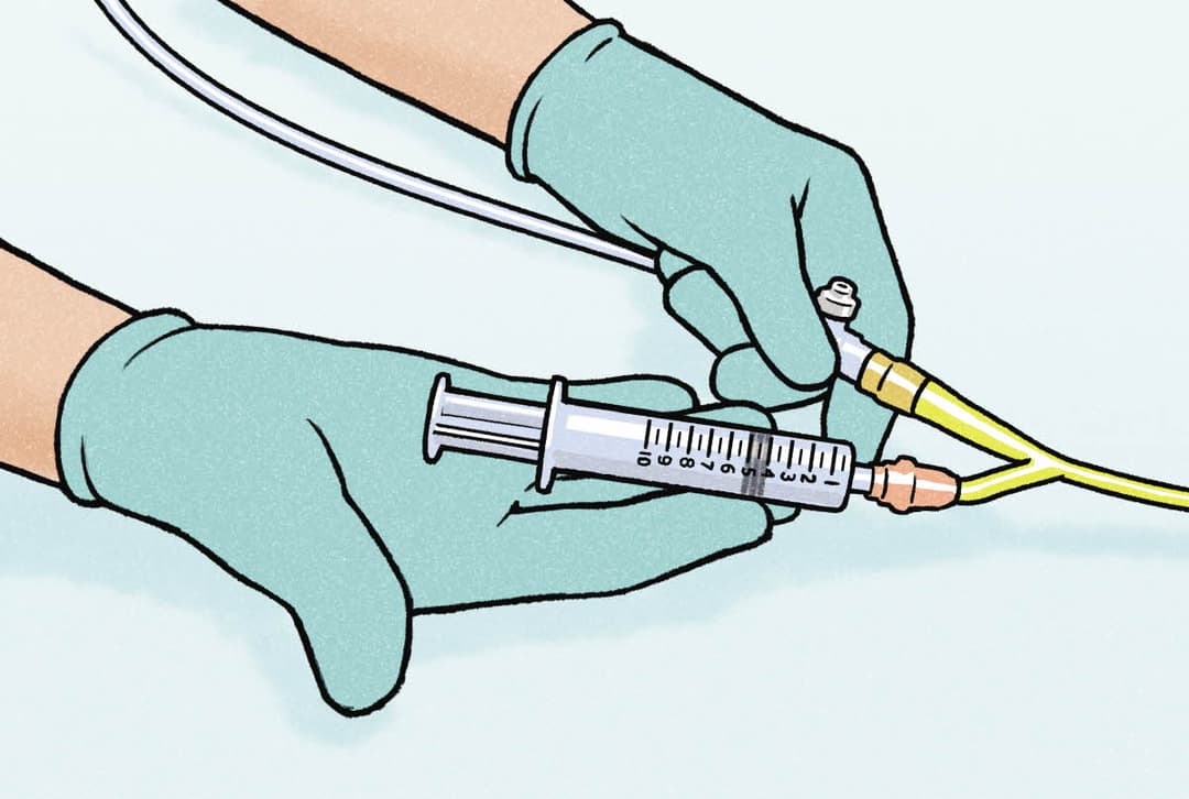 Proper Drain Bag Placement