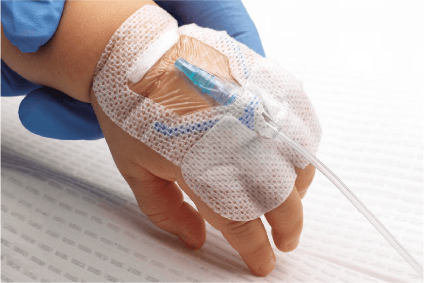 Neonatal & Pediatric Vascular Access Training (1.0 CE for Nurses)