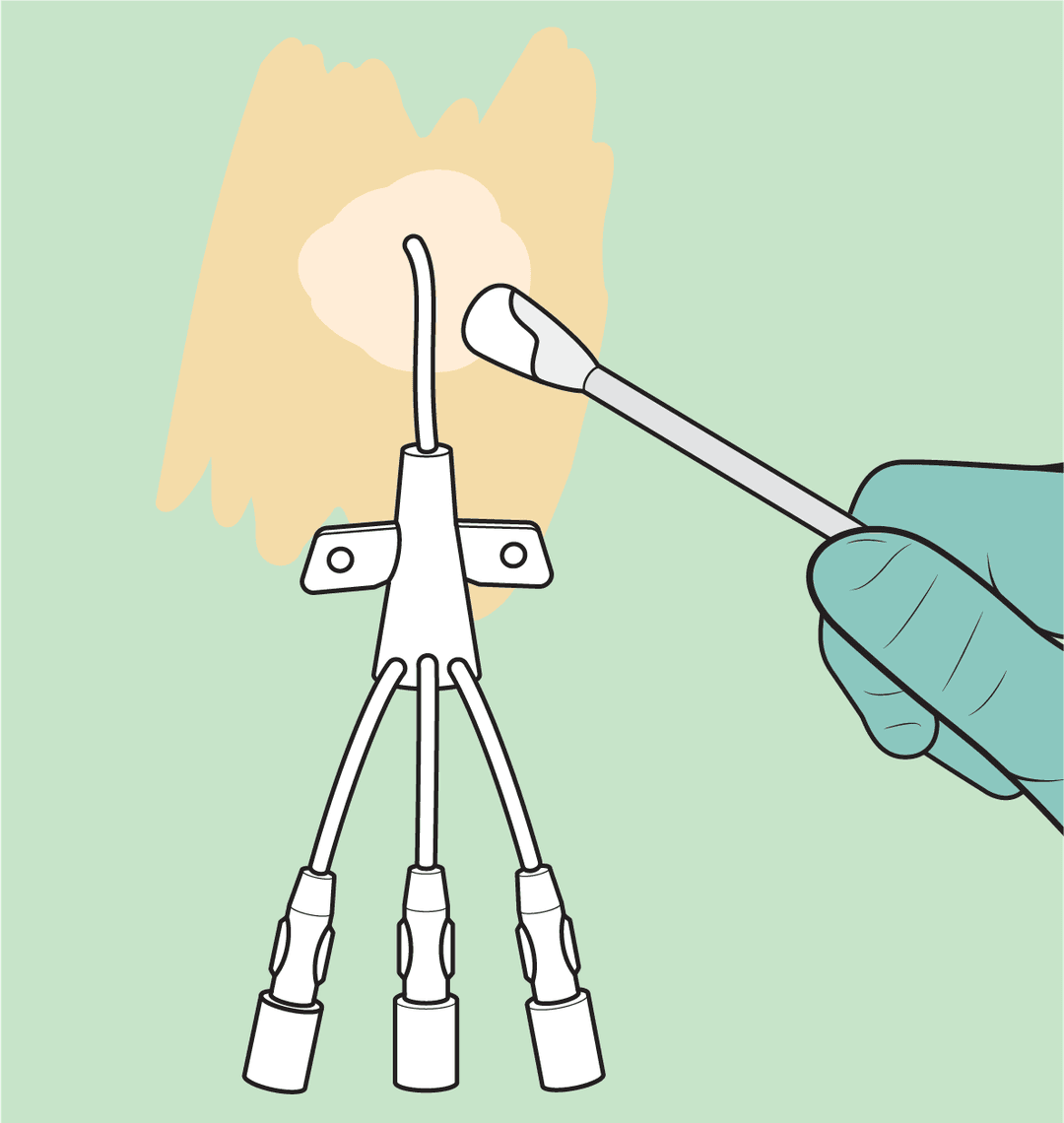 Protecting Patient Skin During Vascular Access