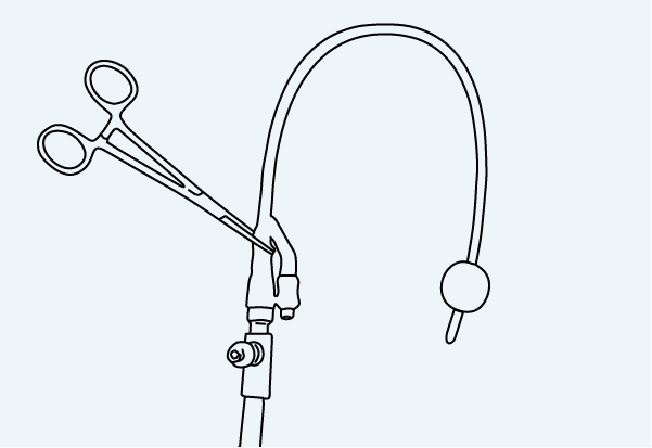 Where to Clamp an Indwelling Urinary Catheter